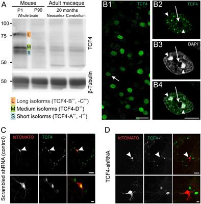 Transcription factor 4 expression in the developing non-human primate brain: a comparative analysis with the mouse brain